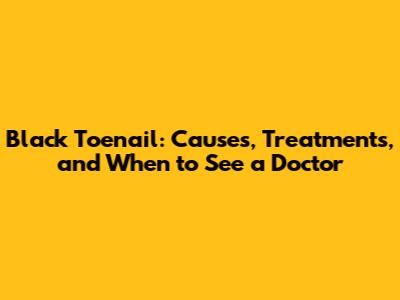 Black Toenail: Causes, Treatments, and When to See a Doctor