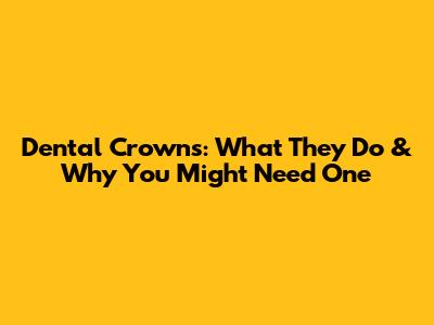 Dental Crowns: What They Do & Why You Might Need One