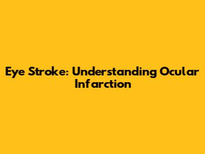Eye Stroke: Understanding Ocular Infarction