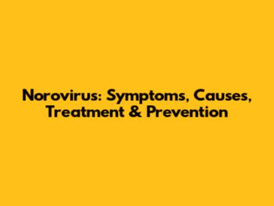 Norovirus: Symptoms, Causes, Treatment & Prevention